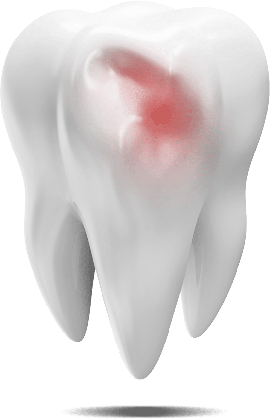 damaged tooth graphic