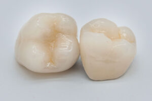 two zirconia crowns that can be used in a zirconia dental implant procedure.