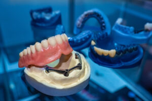 image of a dental implant denture on a prosthesis jaw in a dark and blue lit aesthetic dental room
