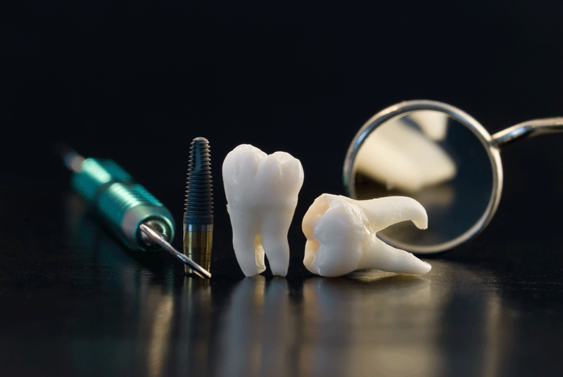 models of dental tools and implants and crowns on a reflective table