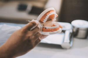 Close-up of a transparent dental implant model with artificial teeth, showcasing metal implants, with a tooth shade guide in the background.