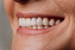 A person smiling, revealing a perfect set of porcelain veneers on their upper teeth, highlighting the aesthetic benefits with a natural look. No text on image.
