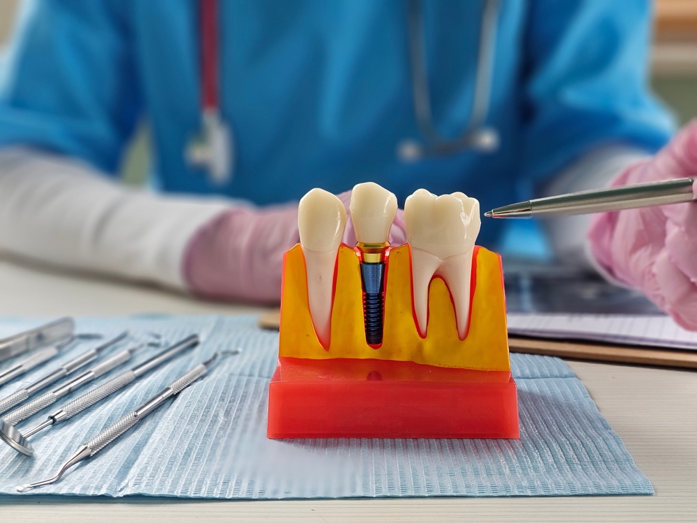 A dentist in blue scrubs and pink gloves points with a pen at a dental implant model, with dental tools neatly arranged on a blue pad—ideal for an SEO pipeline or content review dashboard visual.