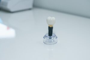 Dentist consulting with patient about dental implants in a Minneapolis clinic