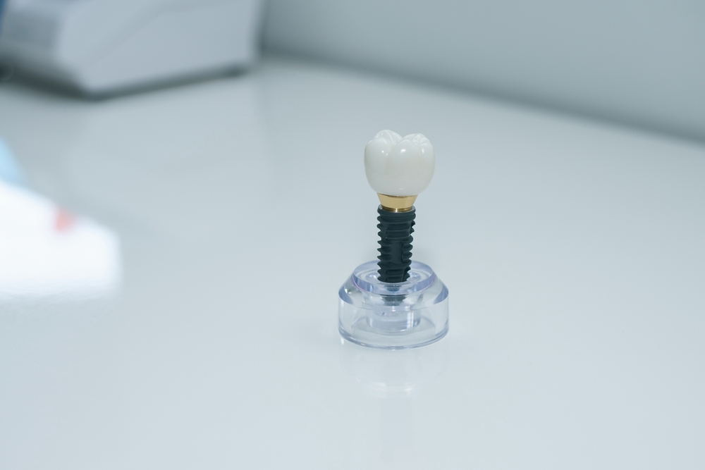 Dentist consulting with patient about dental implants in a Minneapolis clinic